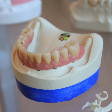 Dentures & denture repair